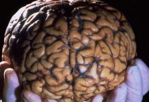 What Happens After the Death Of Human Body- The Brain Is Still Alive What Happens After the Death Of Human Body- The Brain Is Still Alive