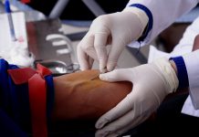 New update in blood test helpful to detect Alzheimer’s accurately New update in blood test helpful to detect Alzheimer's accurately