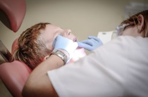 Treating Childhood Front Teeth Injuries