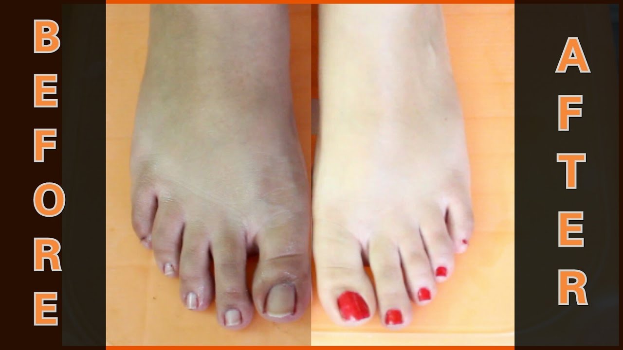 How To Do Feet Whitening Pedicure at Home