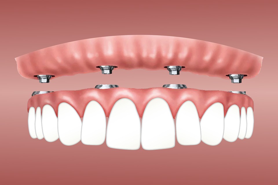 Innovations In Gum Treatment - The Microsurgical Approach